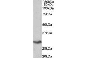 Western Blotting (WB) image for anti-V-Set Domain Containing T Cell Activation Inhibitor 1 (VTCN1) (Internal Region) antibody (ABIN2465019) (VTCN1 antibody  (Internal Region))