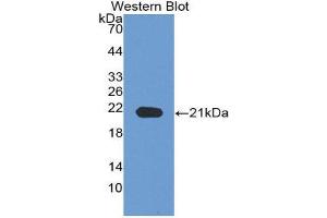 Western Blotting (WB) image for anti-Neuropilin 1 (NRP1) (AA 646-814) antibody (ABIN1860060) (Neuropilin 1 antibody  (AA 646-814))