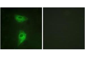 Immunofluorescence analysis of HeLa cells, using IGF2R (Ab-2409) Antibody. (IGF2R antibody  (AA 2381-2430))
