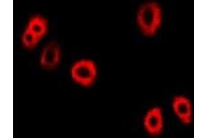 Immunofluorescent analysis of UBE2C staining in Hela cells. (UBE2C antibody)