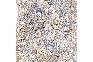 Immunohistochemistry (IHC) image for anti-C-Abl Oncogene 1, Non-Receptor tyrosine Kinase (ABL1) (AA 490-590) antibody (ABIN3020872)