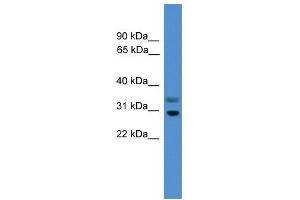 WB Suggested Anti-RGS18 Antibody Titration:  0. (RGS18 antibody  (Middle Region))
