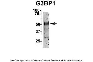 IP Suggested Anti-G3BP1 Antibody Positive Control: NT2 CELL/BRAIN TISSUE (G3BP1 antibody  (N-Term))