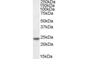 ABIN185188 (0. (Transgelin antibody  (C-Term))