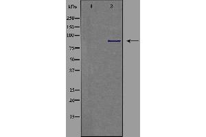 Western blot analysis of extracts from COLO cells, using CDH9 antibody.