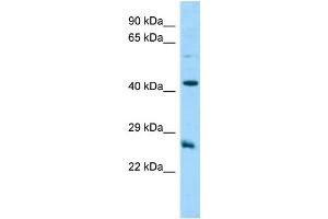 Host: Rabbit Target Name: C18orf26 Sample Type: MCF7 Whole Cell lysates Antibody Dilution: 1. (DYNAP antibody  (N-Term))