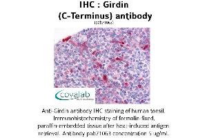 Image no. 1 for anti-Coiled-Coil Domain Containing 88A (CCDC88A) (C-Term) antibody (ABIN1734702) (Girdin antibody  (C-Term))