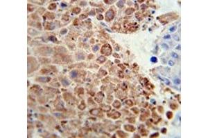 Immunohistochemistry (IHC) image for anti-phosphoglycerate Dehydrogenase (PHGDH) (AA 249-277) antibody (ABIN3032220)