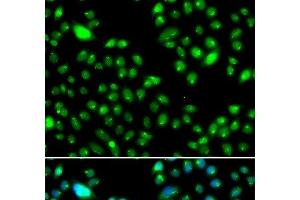 L3MBTL3 antibody