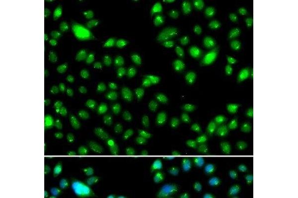 L3MBTL3 antibody