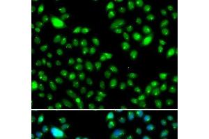 Immunofluorescence analysis of MCF-7 cells using L3MBTL3 Polyclonal Antibody (L3MBTL3 antibody)