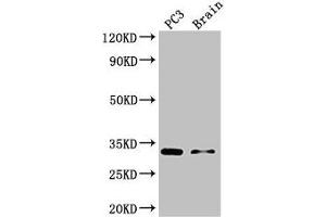 Western Blot Positive WB detected in: PC-3 whole cell lysate, Mouse brain tissue All lanes: HOXB13 antibody at 3 μg/mL Secondary Goat polyclonal to rabbit IgG at 1/50000 dilution Predicted band size: 31 kDa Observed band size: 31 kDa