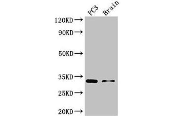 HOXB13 antibody  (AA 1-161)