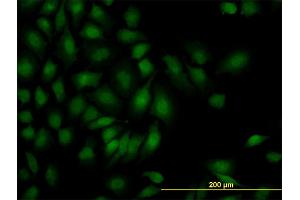 Immunofluorescence of monoclonal antibody to SMAD1 on HeLa cell. (SMAD1 antibody  (AA 1-110))