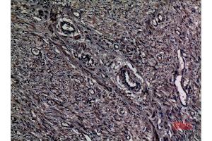 Immunohistochemistry (IHC) analysis of paraffin-embedded Human Uterus, antibody was diluted at 1:100. (A1BG antibody  (Internal Region))
