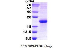 Image no. 1 for Neuroblastoma 1, DAN Family BMP Antagonist (NBL1) protein (His tag) (ABIN1098541) (NBL1 Protein (His tag))