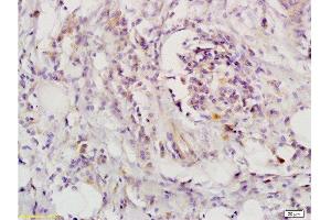 Immunohistochemistry (Paraffin-embedded Sections) (IHC (p)) image for anti-Leukemia Inhibitory Factor Receptor alpha (LIFR) (AA 451-580) antibody (ABIN686827)