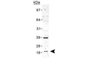 Western blot analysis of TMED10 in human liver lysate with TMED10 polyclonal antibody . (TMED10 antibody  (AA 50-150))