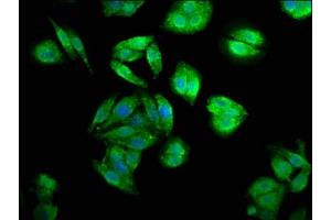 Immunofluorescence staining of HepG2 cells with ABIN7147362 at 1:200, counter-stained with DAPI. (CENPJ antibody  (AA 1082-1248))