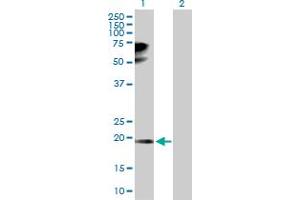 Western Blot analysis of TPRKB expression in transfected 293T cell line by TPRKB MaxPab polyclonal antibody. (TPRKB antibody  (AA 1-175))