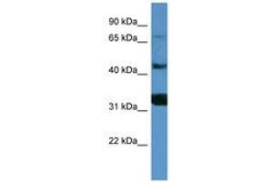 Image no. 1 for anti-Antigen P97 (Melanoma Associated) Identified By Monoclonal Antibodies 133.2 and 96.5 (MFI2) (AA 518-567) antibody (ABIN6746807) (MFI2 antibody  (AA 518-567))