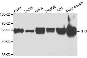 Western blot analysis of extracts of various cell lines, using TFG antibody (ABIN5975639) at 1/1000 dilution. (TFG antibody)