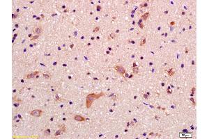 Formalin-fixed and paraffin embedded rat brain labeled with Anti-GRID2IP Polyclonal Antibody, Unconjugated (ABIN1386525) at 1:200 followed by conjugation to the secondary antibody and DAB staining (GRID2IP antibody  (AA 921-1020))