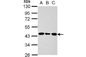 WB Image Sample (30 ug of whole cell lysate) A: 293T B: A431 C: HeLa 10% SDS PAGE antibody diluted at 1:1000