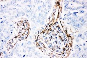 Immunohistochemistry (IHC) image for anti-Caveolin 1, Caveolae Protein, 22kDa (CAV1) (AA 4-178) antibody (ABIN3030338)