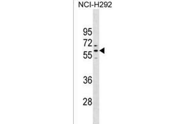 PRAMEF1 Antikörper  (C-Term)