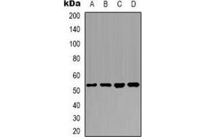 Western blot analysis of PTEN expression in Hela (A), MCF7 (B), NIH3T3 (C), mouse brain (D) whole cell lysates.