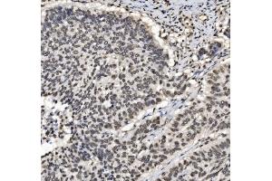 IHC analysis of DBC-1/CCAR2 using anti-DBC-1/CCAR2 antibody (ABIN7602235). (CCAR2 antibody  (AA 65-917))