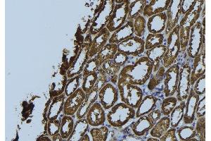 ABIN6272356 at 1/100 staining Rat kidney tissue by IHC-P. (NDUFS5 antibody  (C-Term))