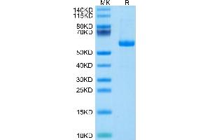 Human Notch 3 on Tris-Bis PAGE under reduced condition. (NOTCH3 Protein (His-Avi Tag))