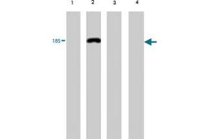 Western blot analysis of extract from red sea bream (lane 1), carp (lane 2), mummichog (lane 3) and medaka (lane 4), using Vitellogenin monoclonal antibody, clone 1G2 . (Vitellogenin 2 antibody)