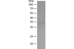 Western Blotting (WB) image for Ribosomal Protein S6 Kinase, 90kDa, Polypeptide 3 (RPS6KA3) (AA 666-740) protein (His-IF2DI Tag) (ABIN7282093) (RPS6KA3 Protein (AA 666-740) (His-IF2DI Tag))