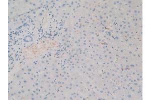 Figure. (SIRPA antibody  (AA 105-324))