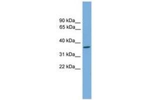 Image no. 1 for anti-General Transcription Factor IIH, Polypeptide 3, 34kD (GTF2H3) (AA 71-120) antibody (ABIN6744650) (GTF2H3 antibody  (AA 71-120))