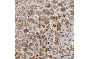 Immunohistochemical staining of human adrenal gland with C14orf119 polyclonal antibody  shows strong cytoplasmic positivity in cortical cells.