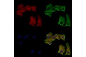 ABIN7093100 and ABIN7097254 staining Hela cells(heat shock treatment) by IF/ICC. (MLKL antibody  (pSer347))