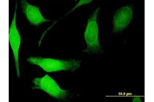 Immunofluorescence of purified MaxPab antibody to NGFRAP1 on HeLa cell. (Nerve Growth Factor Receptor (TNFRSF16) Associated Protein 1 (NGFRAP1) (AA 1-101) antibody)