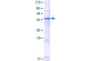 Image no. 1 for Zinc Finger, DHHC-Type Containing 24 (ZDHHC24) (AA 1-284) protein (GST tag) (ABIN1325697) (ZDHHC24 Protein (AA 1-284) (GST tag))