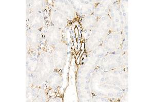 Immunohistochemistry of paraffin-embedded mouse kidney using Annexin  Rabbit pAb  at dilution of 1:25 (40x lens). (Annexin A2 antibody)