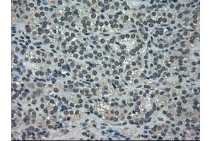 Immunohistochemical staining of paraffin-embedded Ovary tissue using anti-NEK6mouse monoclonal antibody. (NEK6 antibody)