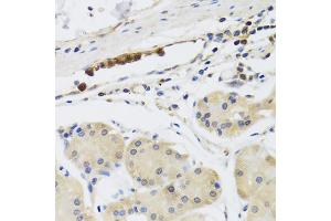Immunohistochemistry of paraffin-embedded human stomach using MB21D1 antibody. (C6orf150 antibody)