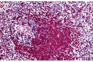 Human Spleen: Formalin-Fixed, Paraffin-Embedded (FFPE) (POLK antibody  (AA 1-473))