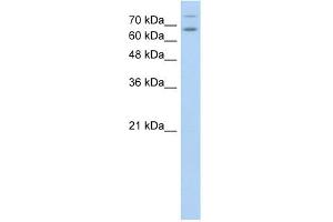 WB Suggested Anti-TSHR Antibody Titration:  0. (TSH receptor antibody  (N-Term))