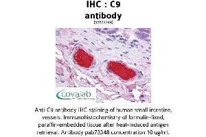 Image no. 1 for anti-Complement Component C9 (C9) (AA 184-411) antibody (ABIN1732510) (C9 antibody  (AA 184-411))