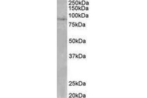 Image no. 1 for anti-SET Domain, Bifurcated 2 (SETDB2) (AA 174-188) antibody (ABIN1104240) (SETDB2 antibody  (AA 174-188))