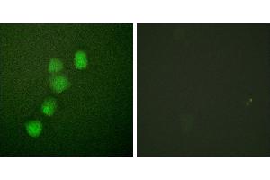 Peptide - +Immunofluorescence analysis of HuvEc cells, using Cyclin(Ab-395) antibody (#B0069). (Cyclin E1 antibody  (Thr395))